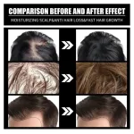 Premium Hair Oil for Men & Women – Nourishing & Moisturizing Hair Care Oil