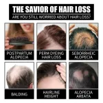 Premium Hair Oil for Men & Women – Nourishing & Moisturizing Hair Care Oil